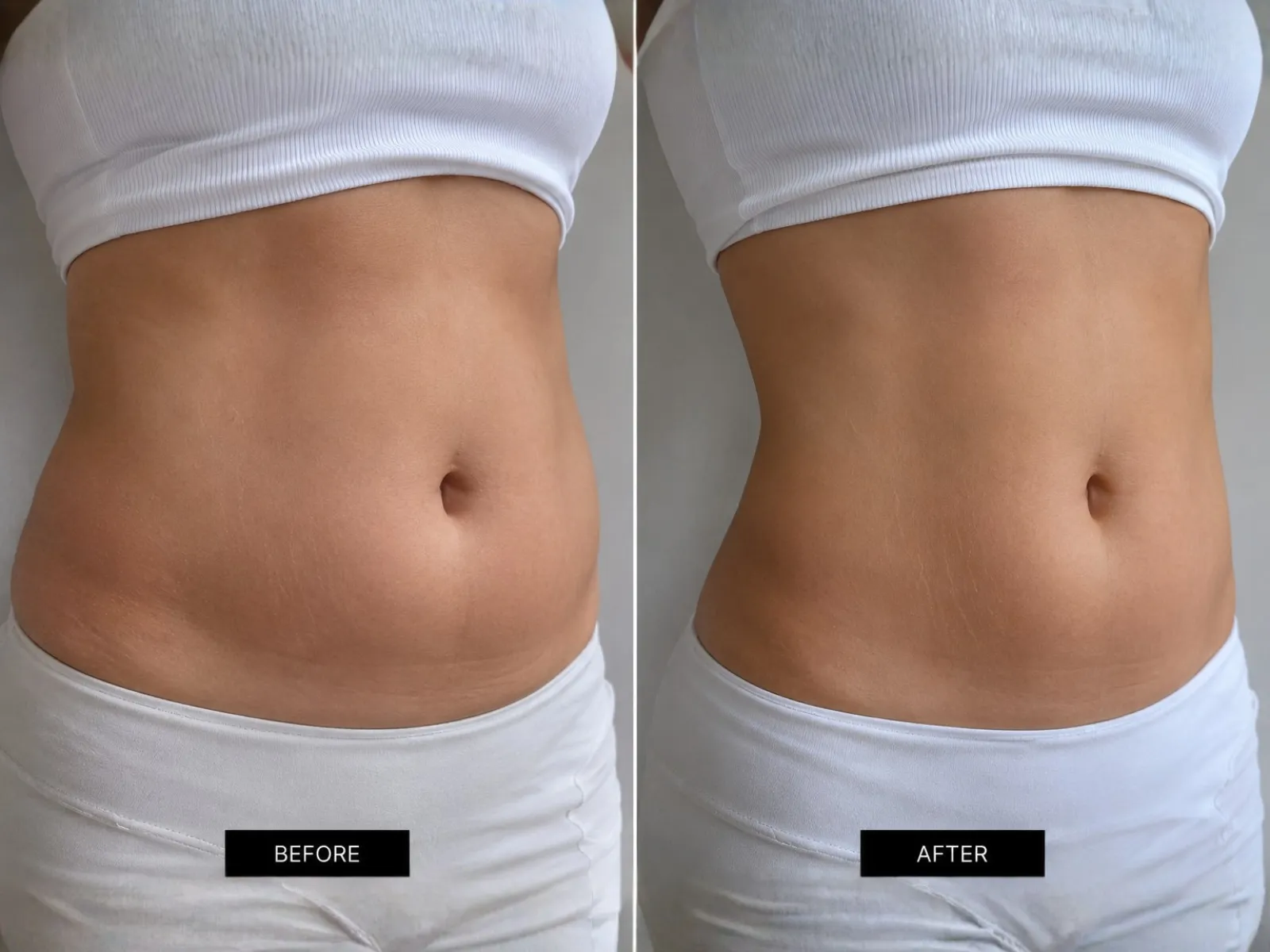 Weight Loss
